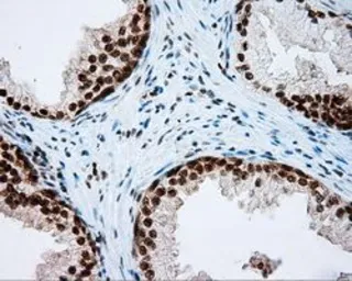 Anti-NPR-C antibody [4C3] used in IHC (Paraffin sections) (IHC-P). GTX84010
