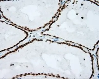 Anti-NPR-C antibody [4C3] used in IHC (Paraffin sections) (IHC-P). GTX84010