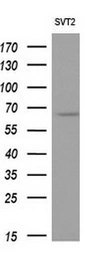 Anti-NPR-C antibody [4C3] used in Western Blot (WB). GTX84010