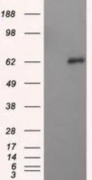 Anti-NPR-C antibody [4C3] used in Western Blot (WB). GTX84010