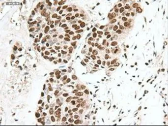 Anti-NOTCH1 antibody [3E12] used in IHC (Paraffin sections) (IHC-P). GTX84019