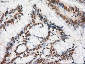 Anti-NOTCH1 antibody [3E12] used in IHC (Paraffin sections) (IHC-P). GTX84019