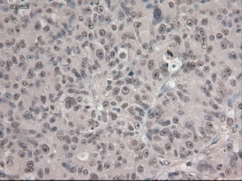 Anti-NOTCH1 antibody [3E12] used in IHC (Paraffin sections) (IHC-P). GTX84019