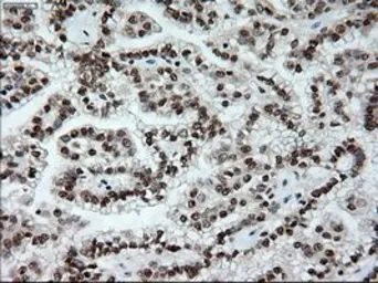 Anti-NOTCH1 antibody [3E12] used in IHC (Paraffin sections) (IHC-P). GTX84019