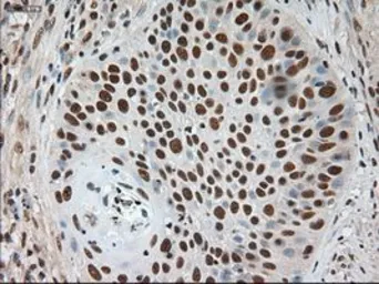 Anti-NOTCH1 antibody [3E12] used in IHC (Paraffin sections) (IHC-P). GTX84019