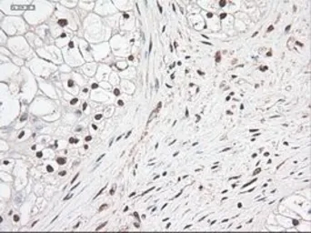 Anti-NOTCH1 antibody [3E12] used in IHC (Paraffin sections) (IHC-P). GTX84019
