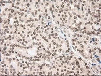 Anti-NOTCH1 antibody [3E12] used in IHC (Paraffin sections) (IHC-P). GTX84019