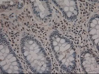 Anti-NOTCH1 antibody [3E12] used in IHC (Paraffin sections) (IHC-P). GTX84019