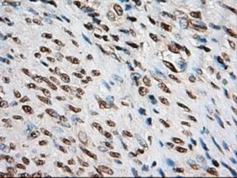 Anti-NOTCH1 antibody [3E12] used in IHC (Paraffin sections) (IHC-P). GTX84019