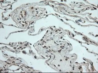 Anti-NOTCH1 antibody [3E12] used in IHC (Paraffin sections) (IHC-P). GTX84019