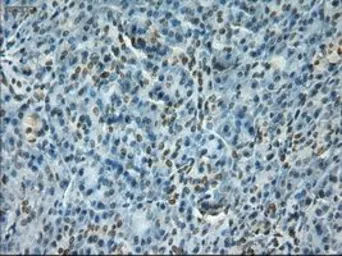 Anti-NOTCH1 antibody [3E12] used in IHC (Paraffin sections) (IHC-P). GTX84019