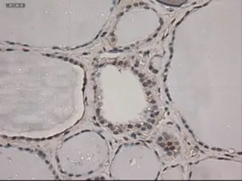 Anti-NOTCH1 antibody [3E12] used in IHC (Paraffin sections) (IHC-P). GTX84019