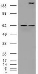 Anti-NOTCH1 antibody [3E12] used in Western Blot (WB). GTX84019