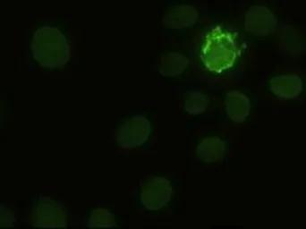 Anti-NOTCH1 antibody [3E12] used in Immunocytochemistry/ Immunofluorescence (ICC/IF). GTX84019