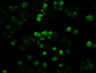 Anti-NOTCH1 antibody [3E12] used in Immunocytochemistry/ Immunofluorescence (ICC/IF). GTX84019