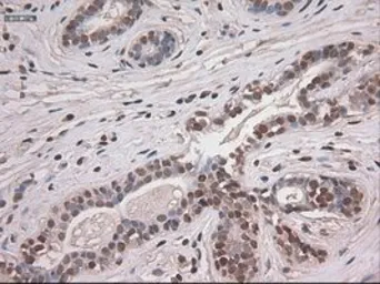 Anti-NOTCH1 antibody [4C9] used in IHC (Paraffin sections) (IHC-P). GTX84020