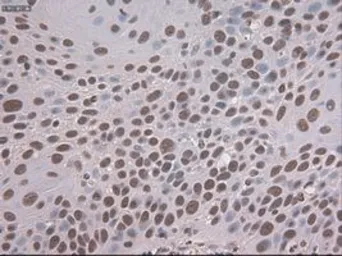 Anti-NOTCH1 antibody [4C9] used in IHC (Paraffin sections) (IHC-P). GTX84020