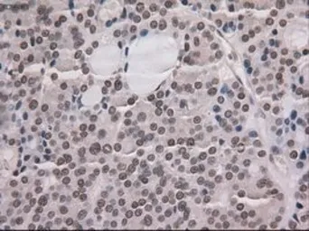 Anti-NOTCH1 antibody [4C9] used in IHC (Paraffin sections) (IHC-P). GTX84020