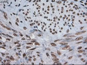 Anti-NOTCH1 antibody [4C9] used in IHC (Paraffin sections) (IHC-P). GTX84020