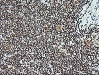 Anti-NOTCH1 antibody [4C9] used in IHC (Paraffin sections) (IHC-P). GTX84020