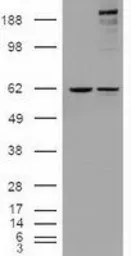 Anti-NOTCH1 antibody [4C9] used in Western Blot (WB). GTX84020