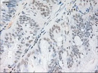 Anti-Noggin antibody [1C1] used in IHC (Paraffin sections) (IHC-P). GTX84021
