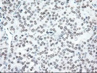 Anti-Noggin antibody [1C1] used in IHC (Paraffin sections) (IHC-P). GTX84021