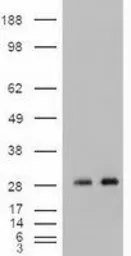 Anti-Noggin antibody [1C1] used in Western Blot (WB). GTX84021