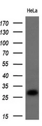 Anti-Noggin antibody [1C1] used in Western Blot (WB). GTX84021