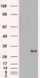 Anti-Noggin antibody [1H8] used in Western Blot (WB). GTX84022