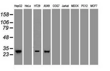 Anti-Noggin antibody [1H8] used in Western Blot (WB). GTX84022