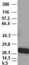 Anti-Noggin antibody [1H8] used in Western Blot (WB). GTX84022