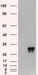 Anti-Noggin antibody [4C12] used in Western Blot (WB). GTX84023