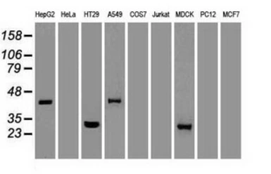 Anti-Noggin antibody [4C12] used in Western Blot (WB). GTX84023