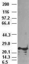 Anti-Noggin antibody [4C12] used in Western Blot (WB). GTX84023