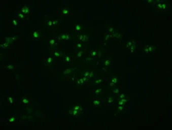 Anti-Noggin antibody [4C12] used in Immunocytochemistry/ Immunofluorescence (ICC/IF). GTX84023