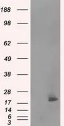Anti-NME4 antibody [5E4] used in Western Blot (WB). GTX84028