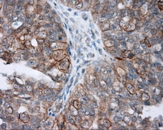 Anti-NME4 antibody [1A5] used in IHC (Paraffin sections) (IHC-P). GTX84032
