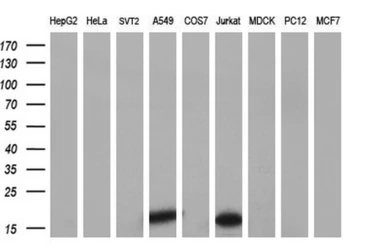 Anti-NME4 antibody [1A5] used in Western Blot (WB). GTX84032