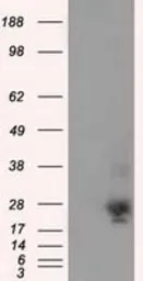 Anti-NME4 antibody [1A5] used in Western Blot (WB). GTX84032