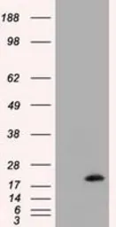 Anti-NME4 antibody [4F10] used in Western Blot (WB). GTX84034