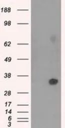 Anti-NIT2 antibody [2B9] used in Western Blot (WB). GTX84036