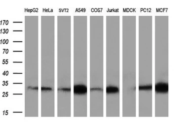 Anti-NIT2 antibody [3D5] used in Western Blot (WB). GTX84039