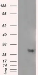 Anti-NIT2 antibody [3D5] used in Western Blot (WB). GTX84039