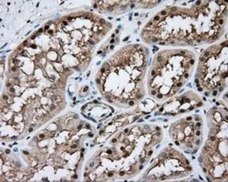 Anti-NIT1 antibody [3A11] used in IHC (Paraffin sections) (IHC-P). GTX84041
