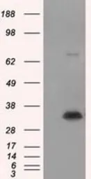 Anti-NIT1 antibody [3A11] used in Western Blot (WB). GTX84041