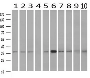 Anti-NIT1 antibody [3A11] used in Western Blot (WB). GTX84041