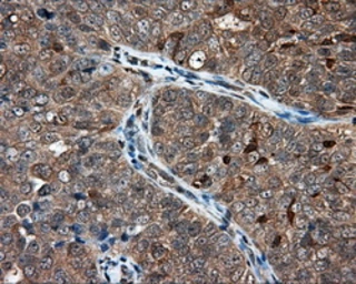 Anti-NIT1 antibody [4D12] used in IHC (Paraffin sections) (IHC-P). GTX84042
