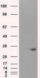 Anti-NIT1 antibody [4D12] used in Western Blot (WB). GTX84042