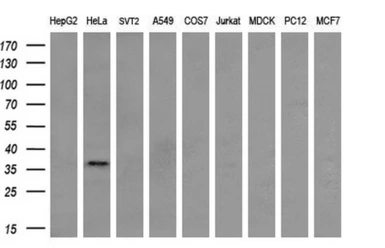 Anti-XLF antibody [3E5] used in Western Blot (WB). GTX84044